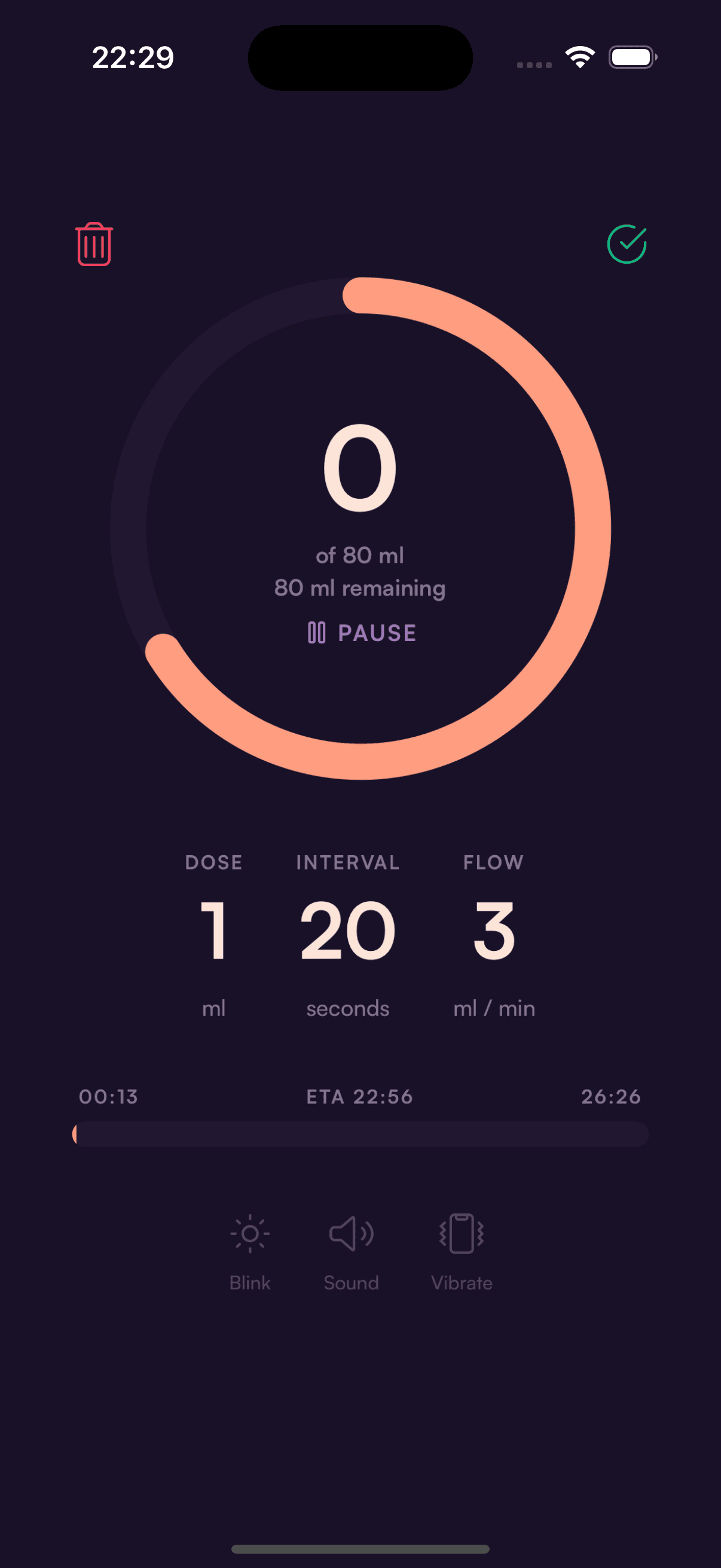 Screenshot of the Tubie app showing a bolus feeding timer