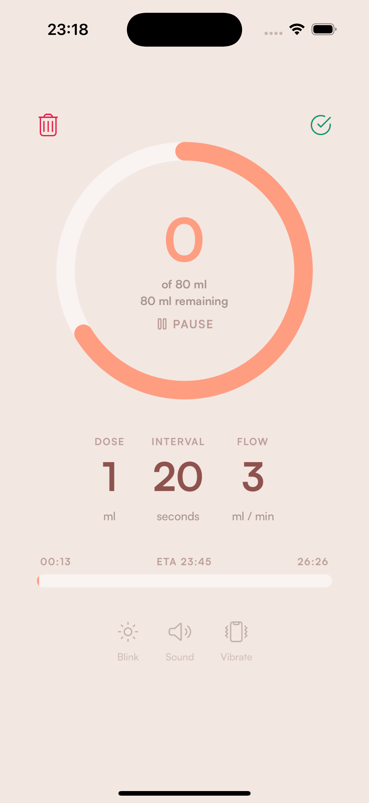 Screenshot of the Tubie app showing a bolus feeding timer